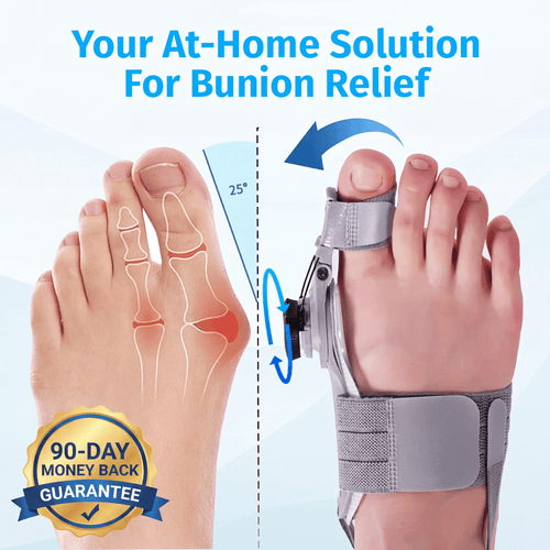 Nouvel Bunion Corrector