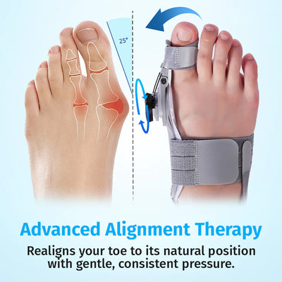 Nouvel Bunion Corrector