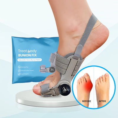 Nouvel Bunion Corrector