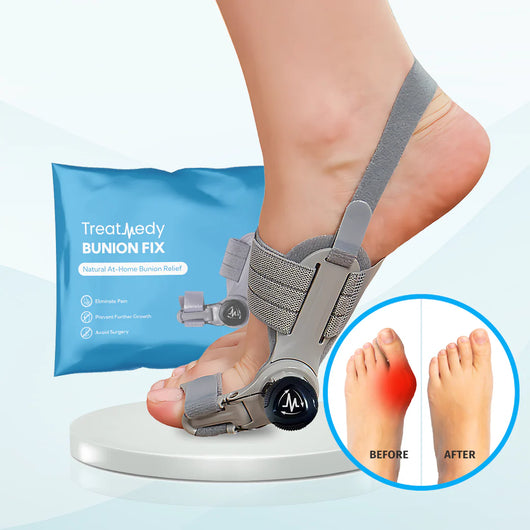 Nouvel Bunion Corrector