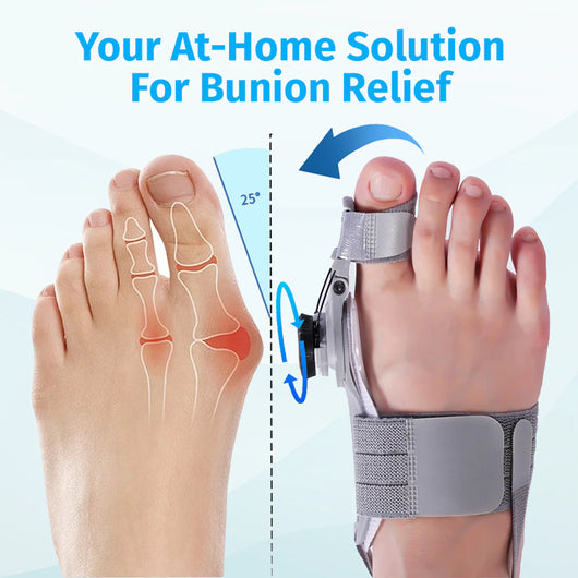 Nouvel Bunion Corrector
